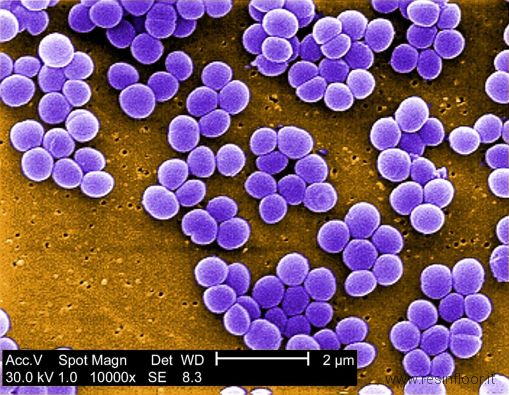 staphylococcus-aureus-bacteria-taken-from-a-vancomycin-intermediate-resistant-culture-visa